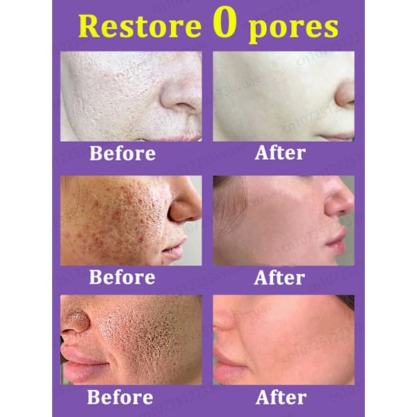 Porer fjerner pore krympende serum krympe oppstramming minimering