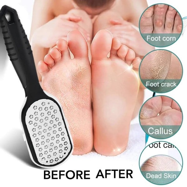 1 bitar Professionell Rostfritt Stål Callus Remover Fot File Scraper Pedikyr Verktyg