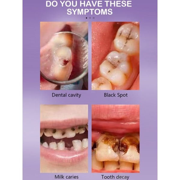 Tann råte reparasjon Reparer alle tann råte hull og beskytt tenner Fjerning av plakk