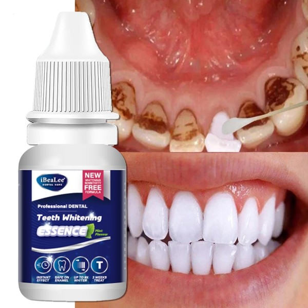 Tänder Whitening Essence Ta bort Plack Fläckar Tand Blek Rengöring Serum