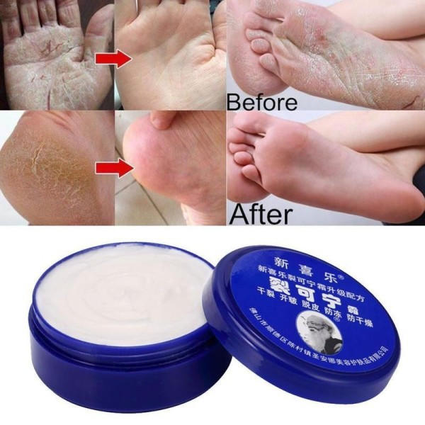 Reparation Hånd Creme Anti-tørrende Hæl Revnet Reparation Urter Crack Fod Creme
