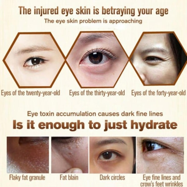 Naturligt ögon serum kräm 7 dagar ta bort mörk cirkel påsar under ögonen förhindra