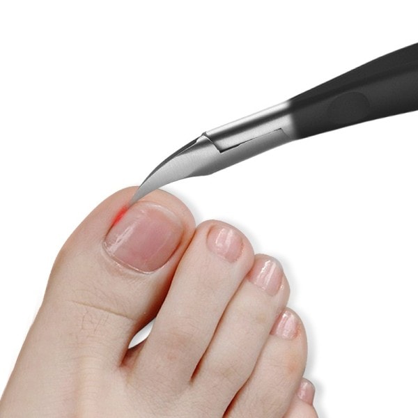 Rostfritt stål nagelklippare trimmer Inåtväxt pedikyr vård proffs Kutter knivar verktyg