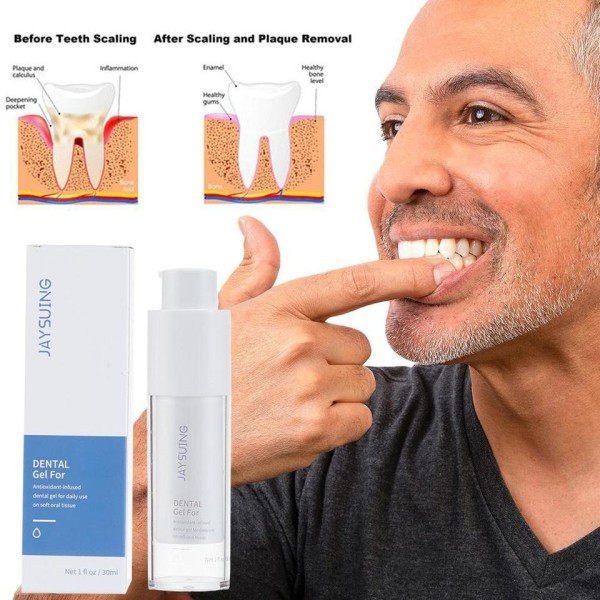 30 ML Menn Og Kvinner Tenner Hviting Gel Whitening Gel For Tennene Bærbar Tannkrem