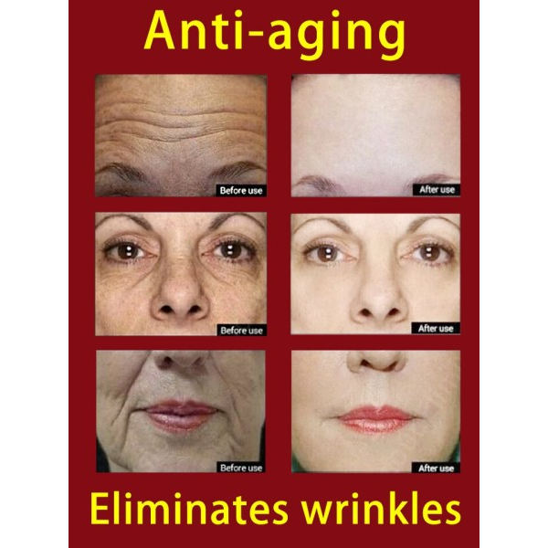 Rynke fjerner ansigt serum løftning opstrammende fade fine linjer anti-aldring essens