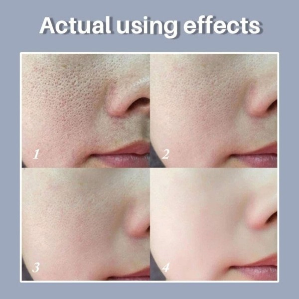 Hud Textur Por Refining Resurfacing Lightening Ansikts Serum med Retinol och Niacinamid