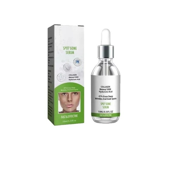 Fregner fjernelse essens fjern ansigtsbehandling pletter hud mørk plet fjern melasma pletter solpletter hvidning og fregne fjernelse creme