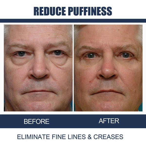 Anti aldring øyekrem reduserer øye rynker retinol anti aldring krem
