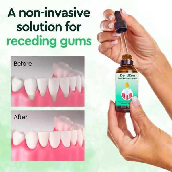 30ml Dentizen Gum Återväxt Droppar Lättande Munn Periodontal Gum Smärta Behandling