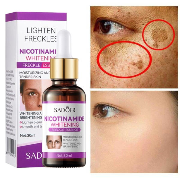 Fräknar Grädde Ta bort Melasma Mörk Fläck Anti-fräknar Essential Essence