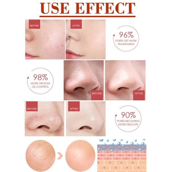 Effektiv porer fjerner pore krympende serum krympe oppstramming minimering