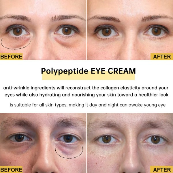Øye krem Multieffekter Rynke Fjerning Anti aldring Oppstramming Puffiness Behandling Under øyne hudpleie