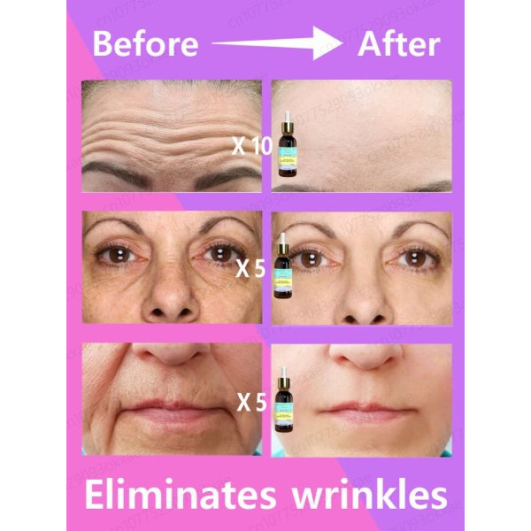 Effektiv anti-aging och anti-rynkor ansiktsbehandling serum för att ta bort ansiktsrynkor