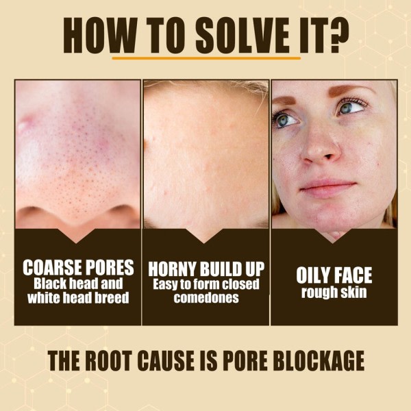 Effektiv porer fjerner pore krympe serum krympe oppstramming minimering
