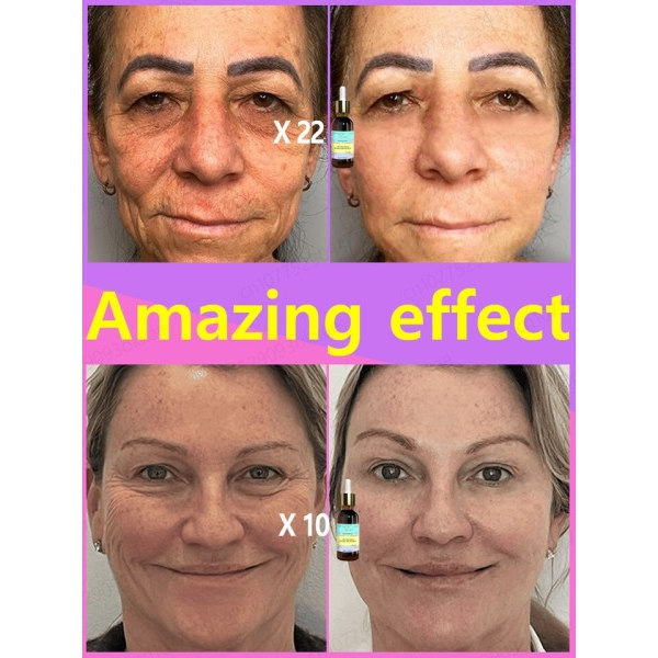 Effektiv anti-aging och anti-rynkor ansiktsbehandling serum för att ta bort ansiktsrynkor