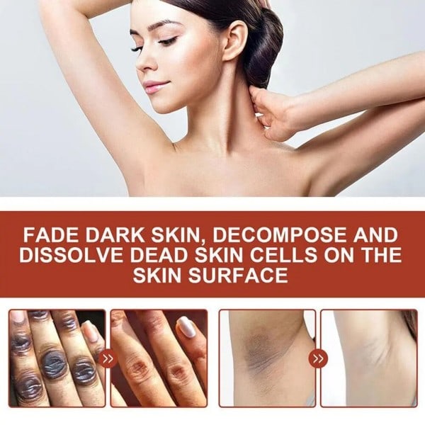 30ml Peeling Olie Albue Knæ Finger Sort Gul Olie Til Hud Lysning Fugtgivende Fjerner døde