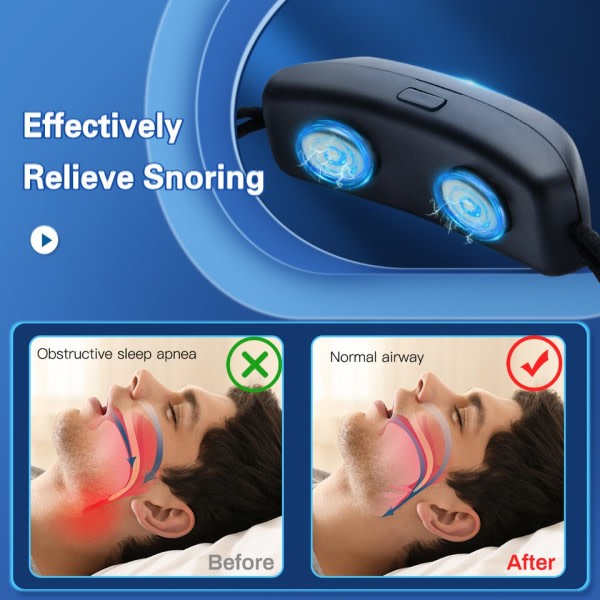 Smart Anti Snorking Enhet EMS Puls Stopp Snorke Bærbar Komfortabel Sov Godt Stopp Snork