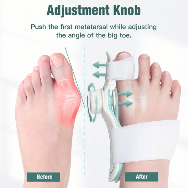 Kniv Korrektor Hallux Valgus Ortotics Big Toe Homing Rightener Justerable Nobs Med 3 Angle