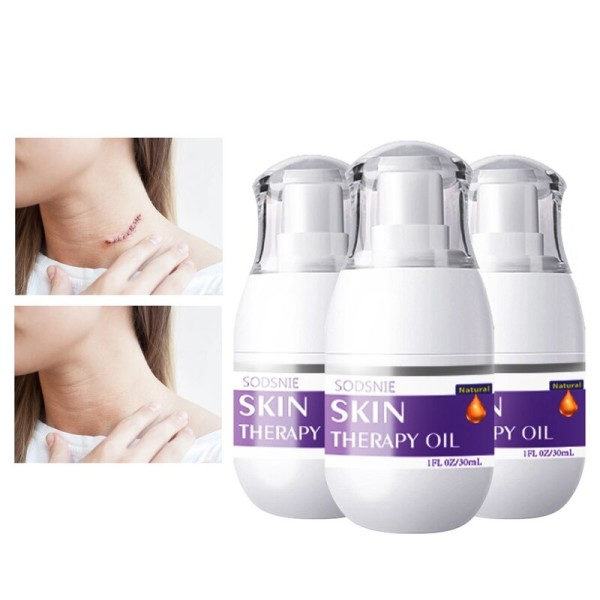 Hud Behandling Olje Nærende Arr Fjerner Stretch Mark Fuktighetsgivende Serum  30ml*3PCS