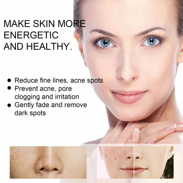 Blegning ansigt creme fjernelse rynker fregne fjernelse anti-acne behandling fade fine linjer