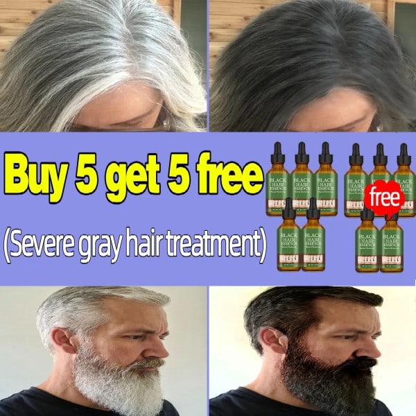 Anti grå hår essens hår sverting serum hvit hår behandling hvit til svart hår reparasjon pleie