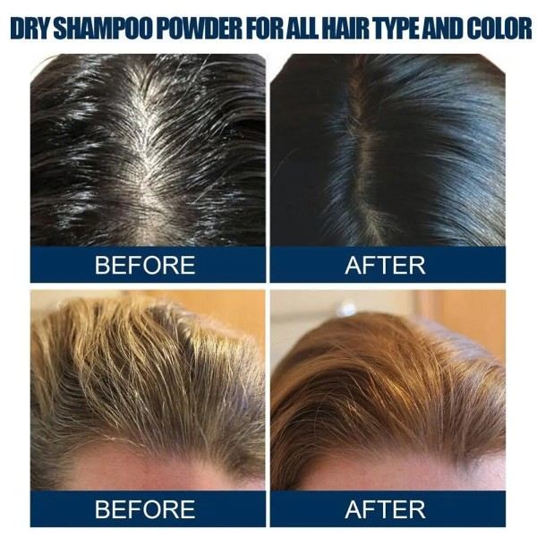 Dry Shampoo Spray Fluffy Hair To Oil Lazy Oil Control Oil Peach No-wash Spray Fluffy Try Remove Shampoo