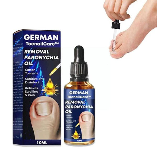Svampe negle behandling essentiel olie hånd og fod blegning svamp fødder paroniki olie neglefjernelse infektion fjernelse