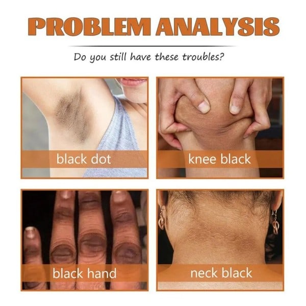30ml Peeling Olie Albue Knæ Finger Sort Gul Olie Til Hud Lysning Fugtgivende Fjerner døde