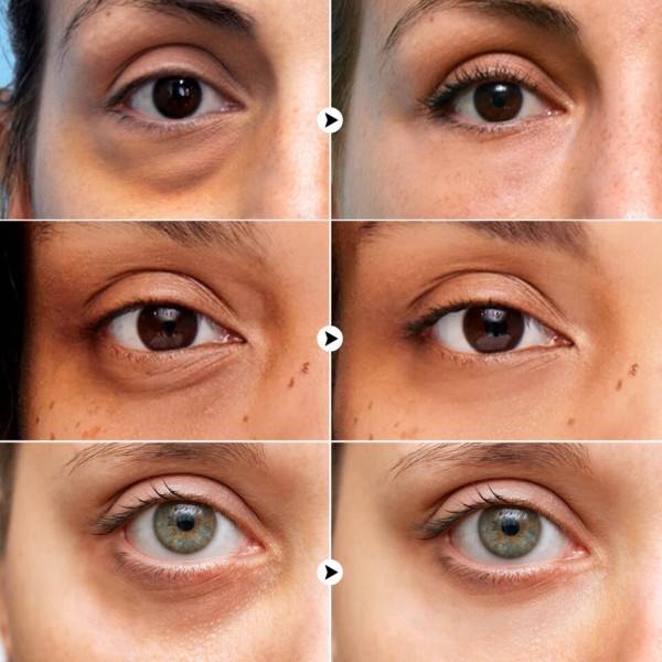 Øye krem Multieffekter Rynke Fjerning Anti aldring Oppstramming Puffiness Behandling Under øyne hudpleie