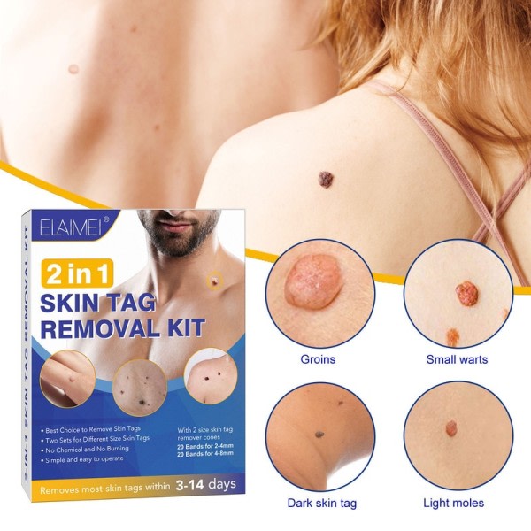 Hud Tag Remover Kit Mulvad Vårta Remover Utrustning Skin Tag Behandling Verktyg