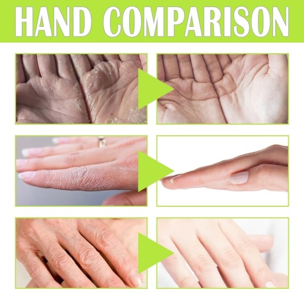Grönt Te Reparera Hand Mask Anti Torr Sprickbildning Vitning Ta bort död hud