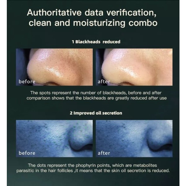 Hydra Dermabrasion Aqua Peeling Skjønnhet Enhet Vann Oxygen Hud Skjønnhet rensende ansiktsbehandling boble maskin