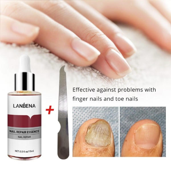 Negle svamp behandling essens serum hånd pleje fod svamp fjernelse reparation gel