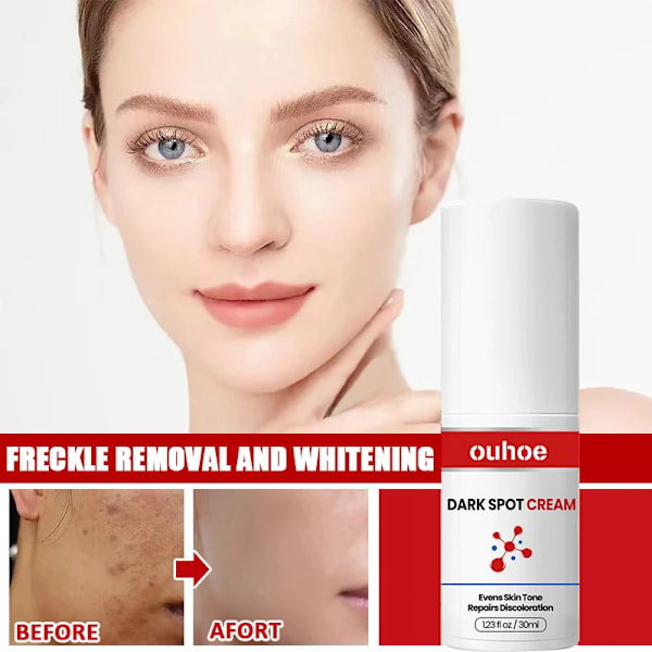 Ta bort Mörka Fläckar Snabb Ljusna upp Förbättra Matthet  Effektiv Bletning Freckles Hudvård