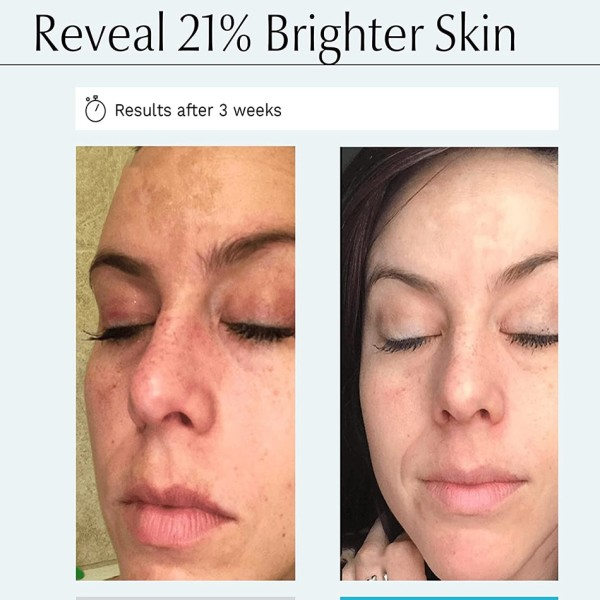 125ml Kojic Sen Concentre Med Collagen Serum Strong Lightening Fade Sta Mørke flekker