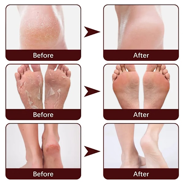 Anti-tørrende Fod creme Eksfoliering Revnet Hæl Reparation Produkt Død Skin Fjernelse creme