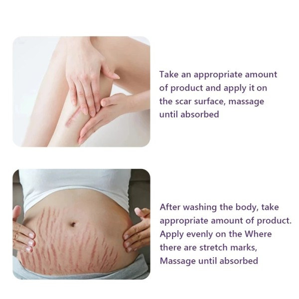Hud Behandling Olje Nærende Arr Fjerner Stretch Mark Fuktighetsgivende Serum  30ml*3PCS