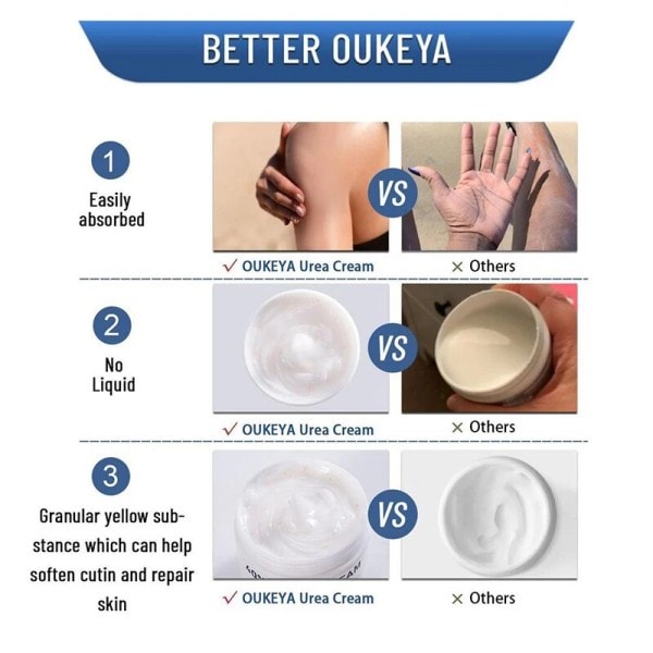 Urea creme 40% til tørre revnede fødder krop hænder hæle reparation cremer behandling hud pleje fugtgivende fjerner hårdt