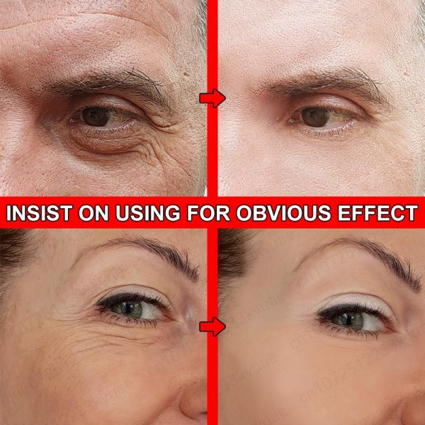 Effektiv Anti-aging Anti-rynkor Ansikts serum för ansiktsbehandling rynkor fina linjer runt ögonen