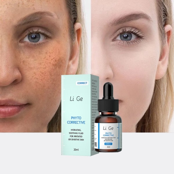 Ansigtsbehandling Pletter Fjernelse Essens Fjern Mørke Alderspletter Pigmentering Lysere Hud Blegning Hvidning Serum