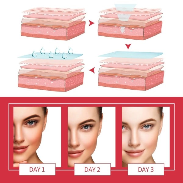 Exfoliator Gel Deeply Cleaning Fjern Død Skin Purifying Pore Cutin Nourishing Forbedre Matthed