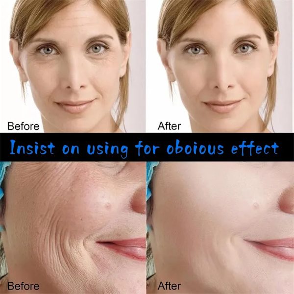 Kollagen Snabb rynkor Ansikte Serum Lifting Firm Fade Remover Fine Lines Anti-Aging Essence