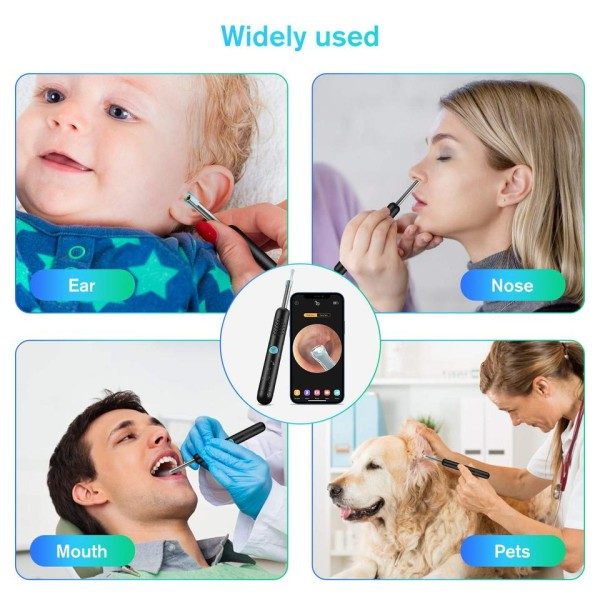 Smart Visuel Ear Sticks Endoskop Høj præcision Ørestik Mini kamera Høj præcision otoskop