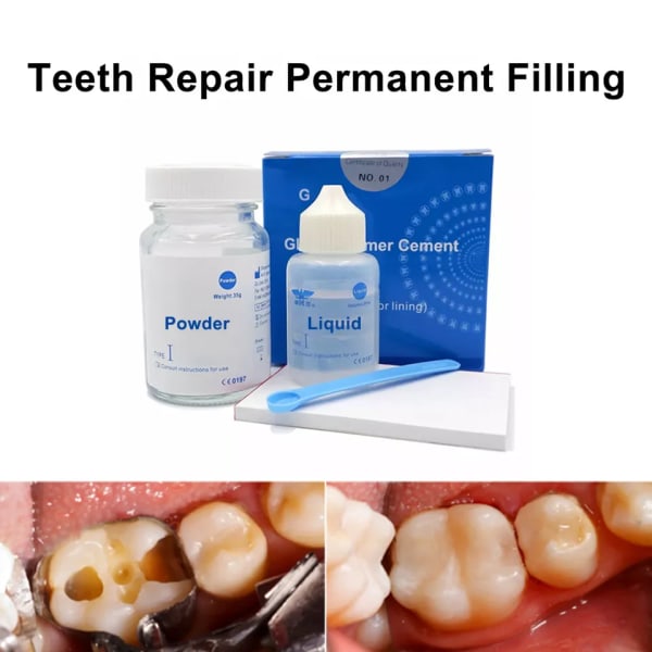 Permanent tänder fyllning reparation kit hemma för oral hål fyllning tand hålrum restaurering material tandvård set