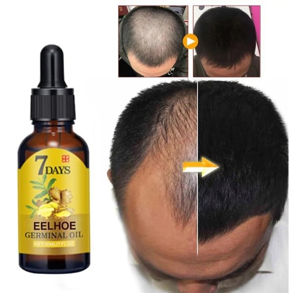 Hår tillväxt serum olja 40 ml tät återväxt ingfära hårvård reparation vätske essentiell anti avfall