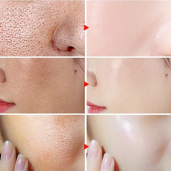 Krymp porer Bli av pormaskar Acne Ljusna upp hudton ansiktsbehandling serum
