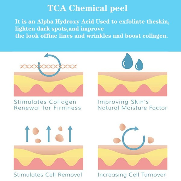 30ml TCA Kemisk Peel 70% Tca Peel Syre Peeling Syre neutralizer sæt hud Superforce Peeling Pigmentering