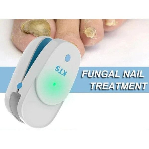 Sopp Negler Behandling Laser Enhet For Negler Sopp Negler Fjerning