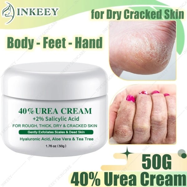 Urea 40% creme til tørre revnede fødder hæle hænder krop reparation behandling dybt fugtgivende hårdhud død hud fjern fod pleje