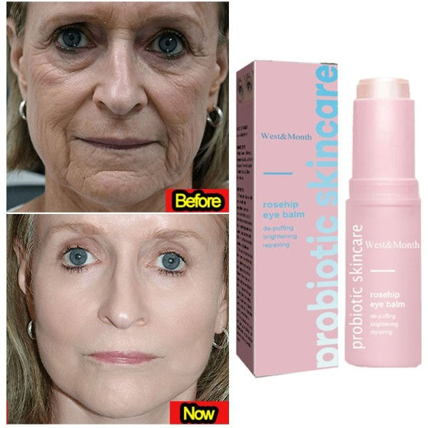 Øyeblikkelig rynke fjerning multi sprett balsam ansiktsbehandling stramming fuktighetsgivende koreansk antirynke balsam pinne krem